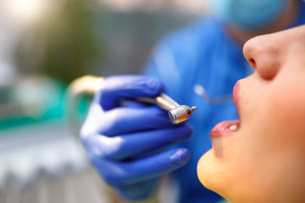 Dental Bonding in Wind Point, WI